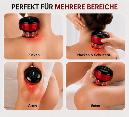 Novora™ Smart Electric Cupping Massager image 3