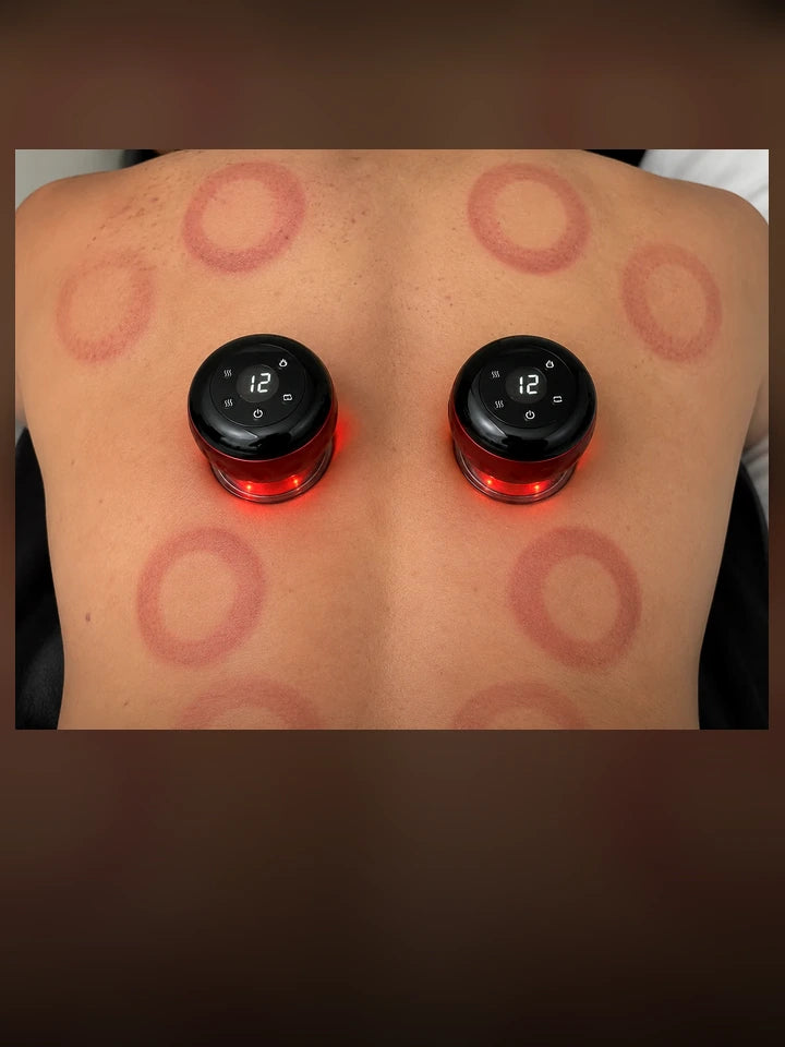 Novora cupping massagers used on back